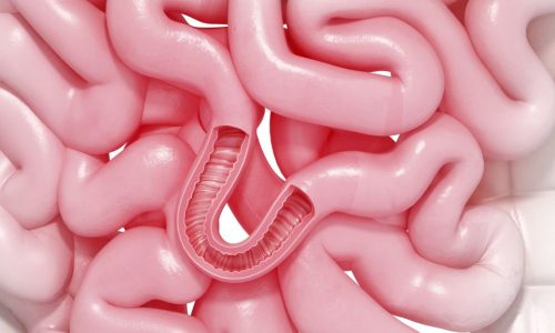 SIBO – zespół przerostu bakteryjnego jelita cienkiego